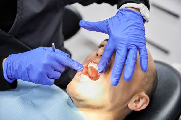Best Emergency Denture Repair in Florissant, MO