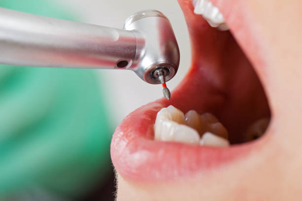 Best Emergency Treatment for Jaw Pain or Injury in Florissant, MO